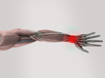 Thread Carpal Tunnel Release - Dr. Daniel Malone in Madison WI